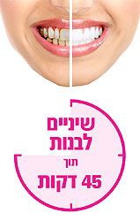 הלבנת שיניים