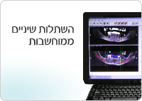 השתלות שיניים ממוחשבות